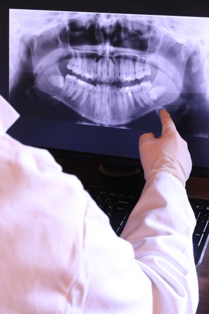 Best Emergency Dental Services for Seniors in Barry, IL