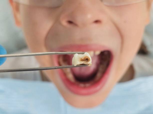 Best Holiday Emergency Dentist in Barry, IL